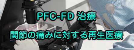PFC-FD 治療,関節の痛みに対する再生医療